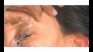Professional Botox Training Video Excerpt