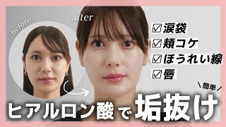 ヒアルロン酸　10/31 Best value for money x Best price] Resolve all your concerns