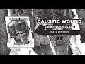 CAUSTIC WOUND - Death Posture (full album stream)