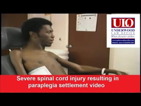 Severe spinal cord injury resulting in paraplegia settlement video.