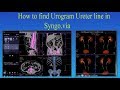 how to find urogram ureter line in syngo via