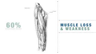MEND Joint Replacement