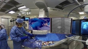 TIPS Part 2 JVIR VR /Haskal