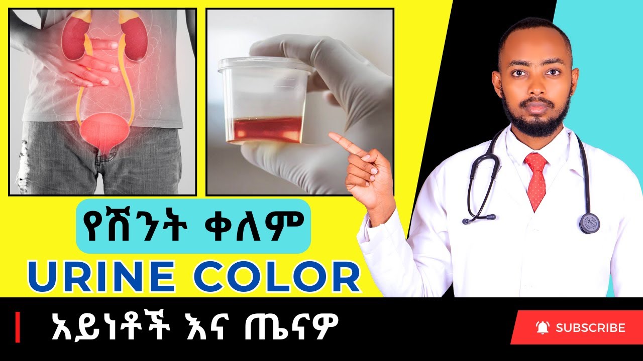 Ethiopia | የሽንት ቀለም አይነቶች እና ጤናዎ
