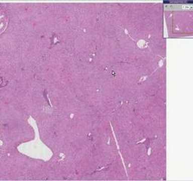 Histopathology Liver--Normal