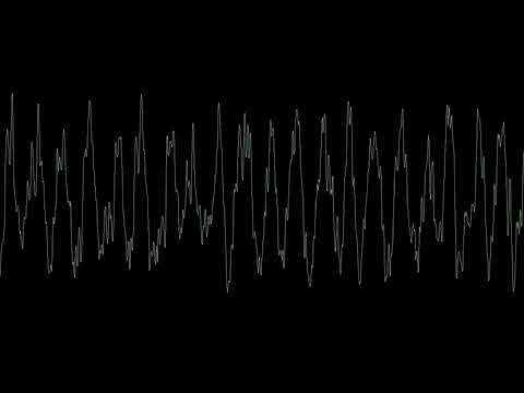Pataphysical — Pataphysical - Sonora