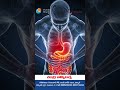Uncontrolled Fever and Its Different Types Explained in Telugu | Chandra Hospitals