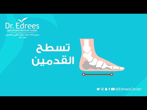 تسطح القدمين لسيدة ثلاثينية مع د خالد إدريس