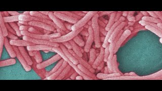 Mayor Mamdani announces new measures to combat Legionnaires disease