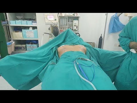 Live Silicone Breast Implant Surgery 475 CC - YouTube