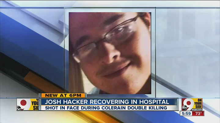 Joshua Hacker needs extensive surgery for wounds f...