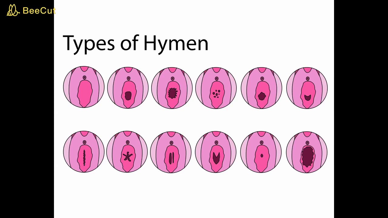 Hymen For Women S Health And More Youtube