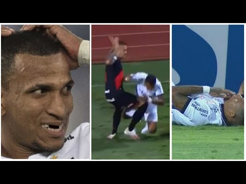 Futbolista Pierde 4 Dientes En Pleno Partido