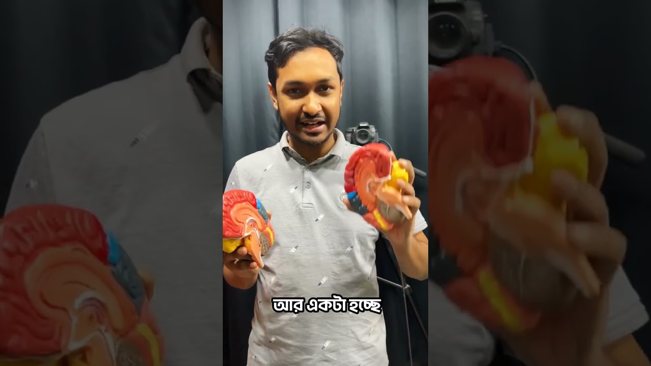 বলোতো এটা কি?🤔 