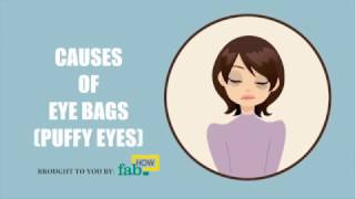 What Causes Bags Under Your Eyes (Puffy Eyes)