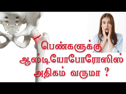 ஆஸ்டியோபோரோசிஸ் என்றால் என்ன? வராமல் தடுப்பது எப்படி? What is Osteoporosis? How to prevent it? Tamil