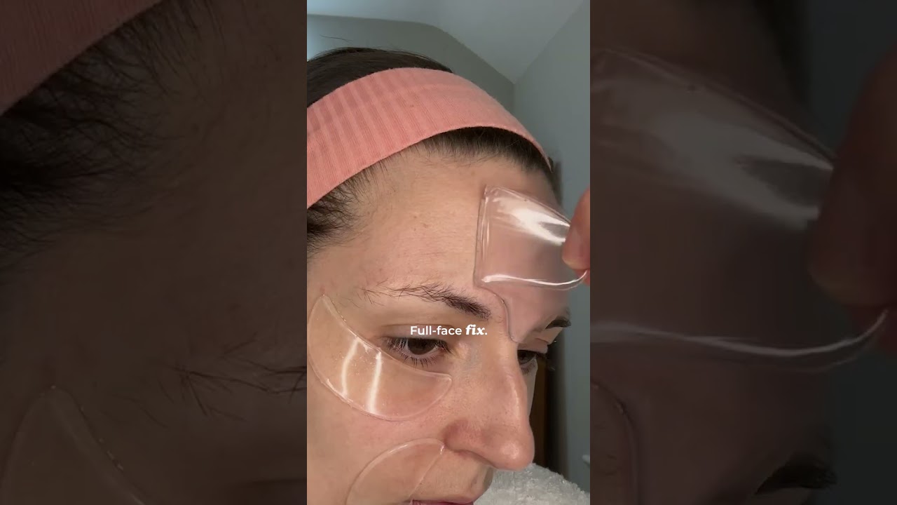 SoSmooth Patches target them all with one simple, science-backed solution. ✨