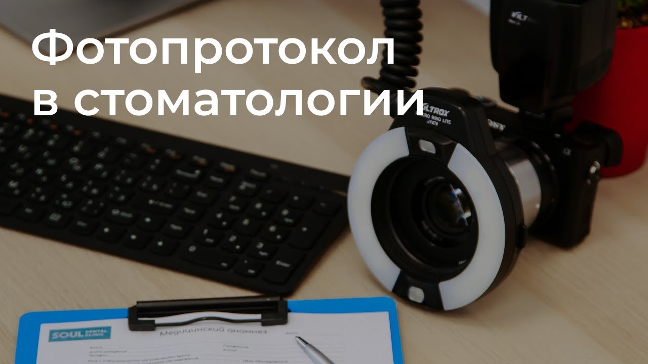 Фотопротокол в стоматологии SOUL dental clinic - YouTube