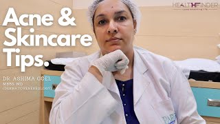 Acne Skin Care Tips by Dr. Ashima Goel | Best Dermatologist In Chandigarh | HealthFinder screenshot 2