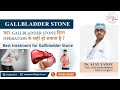 Management of Gall Bladder Stones