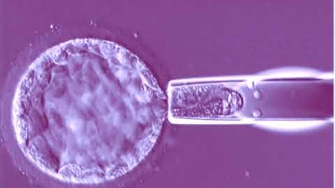 Embryo Biopsy