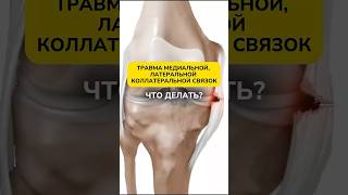 ТРАВМЫ СВЯЗОК КОЛЕНА #больвколене #коленныйсустав #связкиколена