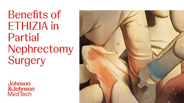 Bleeding Management in Partial Nephrectomy Procedure with ETHIZIA Hemostatic Patch | J&J MedTech