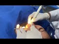 ពេទ្យធ្មេញខ្មែរធីស Khmer Teeth Dental Clinic