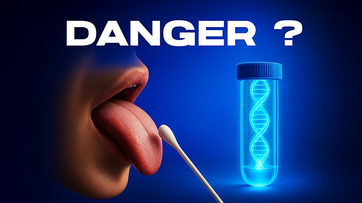 Why does France formally ban DNA testing?