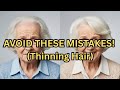 Thinning Hair At the Temples/Hairline: AVOID THESE MISTAKES!