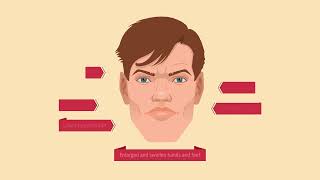 Acromegaly Animation