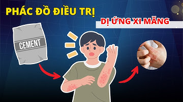 PHÁC ĐỒ ĐIỀU TRỊ DỊ ỨNG XI MĂNG MỚI NHẤT | DS. Thu Hằng – Eduphar