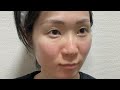 【視聴注意】ア◯ルは外科医に浣腸されました。#腹痛 #うんち