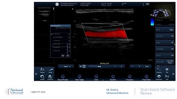 GE Vivid IQ Scan Assist Software Training Video