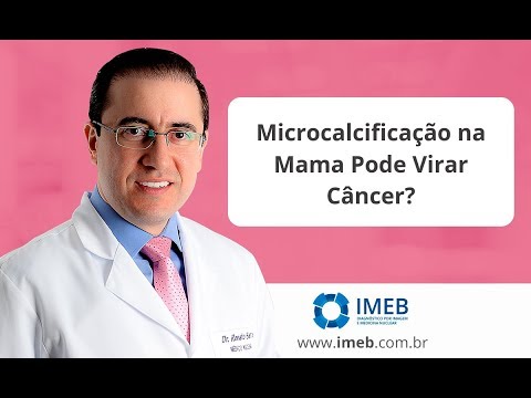 Vídeo: A calcificação na mama pode desaparecer?