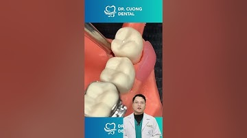 Cận cảnh nhổ răng khôn mọc ngầm | Bác sĩ Cường