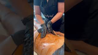 Ice Body Sculpting with PureSculpt ICE