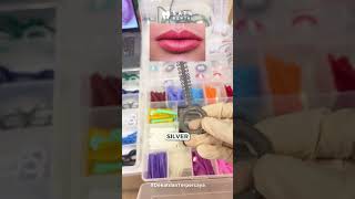 Pilihan warna karet behel ini bisa kamu coba untuk warna lipstick favoritmu😉