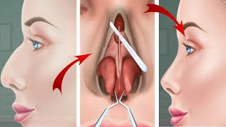 Asmr long nose cosmatic multi surgery hospital game | gamerprincess | games | 3d surgery games | new screenshot 5
