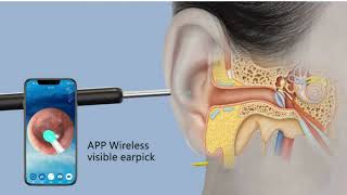 Natfire Ne3 Ear Cleaner High Precision Ear Wax Removal Tool With Led Camera