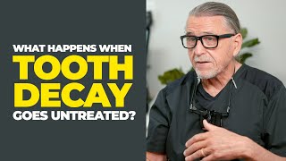 What happens when tooth decay goes untreated