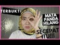 CARA MENGHILANGKAN  KANTUNG MATA