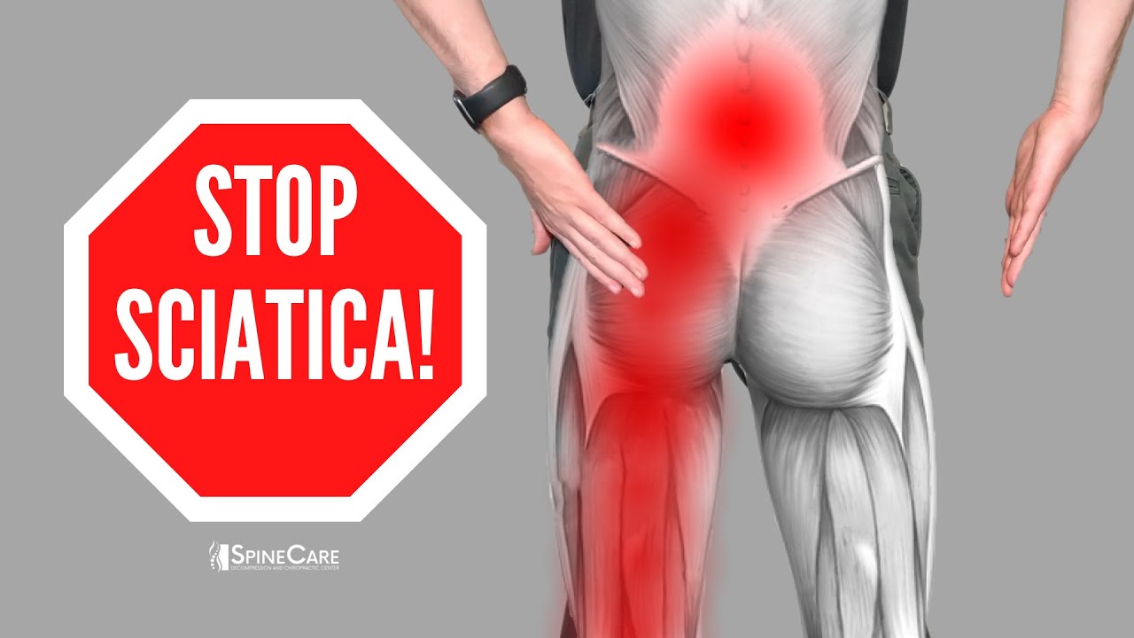 Sciatica pain relief with massage #sciatica #massage #trending