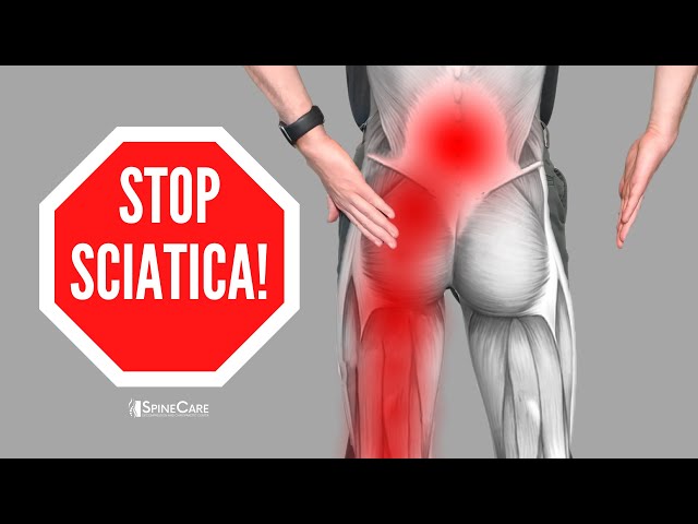 Sciatica Pain Relief - Take pressure off the sciatic nerve