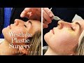 Rhinoplasty Surgical Footage - Go Into The Operating Room For A Nose Job Procedure