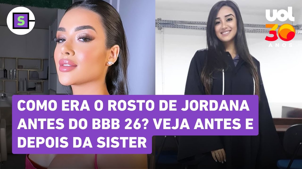 Jordana do BBB 26 antes e depois: sister fez lipo, harmonização e mais procedimentos; veja
