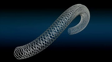 Self Expanding Stent Supera