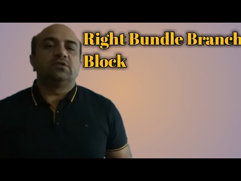 ecg....right-bundle-branch-block(rbbb)