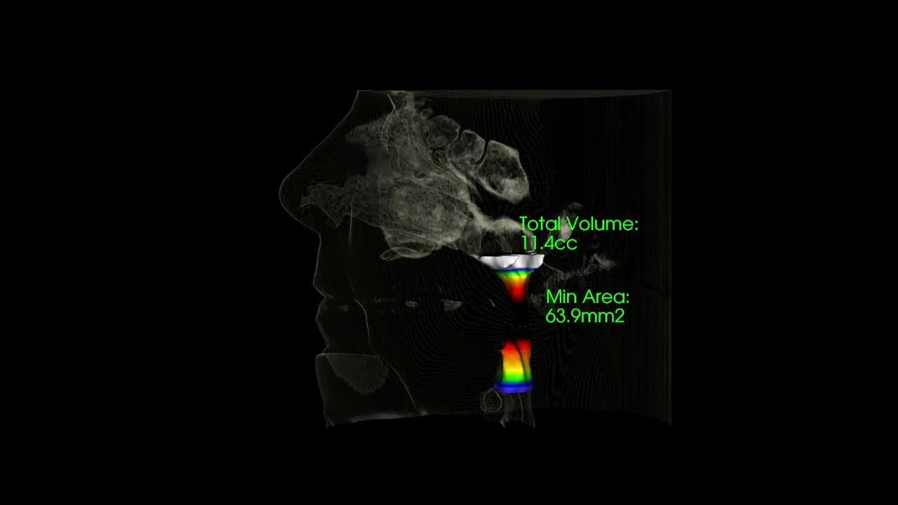 Comprehensive Family Dental 3D CBCT Skull Xray Victoria, TX YouTube