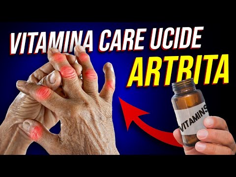 Cea mai Bună Vitamină pentru Prevenirea și Tratarea Artritei!